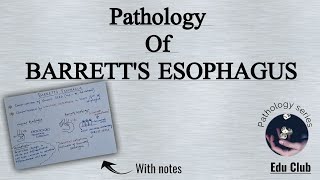 Barretts Esophagus  GIT Pathology [upl. by Aya]