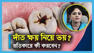 দাঁত ক্ষয় রোধ করবেন যেভাবে  how to get rid from tooth decay [upl. by Cynthia]