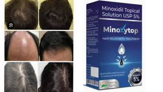 Minoxytop HAIR REGROWTH TREATMENT Minoxidil Topical Solution USP 5 [upl. by Eenhpad594]