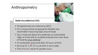 Anthropometry Measurements in Newborn  Pediatrics [upl. by Anselma]