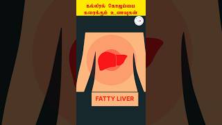 கல்லீரல் கொழுப்பை கரைக்கும் உணவுகள்  fattyliver healthtips  Dr Sagul R Mugunthan [upl. by Cigam991]