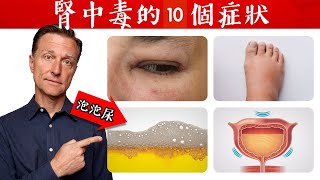 腎中毒的10個症狀自然療法柏格醫生 Dr Berg [upl. by Yllim645]