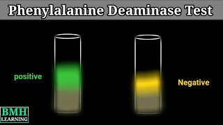 Phenylalanine Deaminase Test [upl. by Calley]