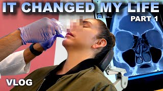 SEPTOPLASTY SURGERY IT CHANGED MY LIFE  VLOG  PART 1 [upl. by Neeoma]