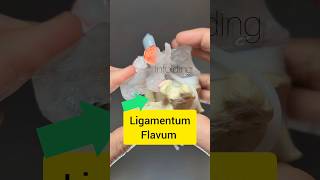 Ligamentum Flavum Modelling  Dynamic Disc Designs [upl. by Mudenihc]