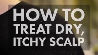 How to Treat a Dry Itchy Scalp  WebMD [upl. by Ainoek]