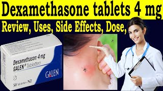 Dexamethasone tablets ip 4mg uses in hindi  review galen 4 mg tablets  Uses Side Effects Dose [upl. by Newnorb]