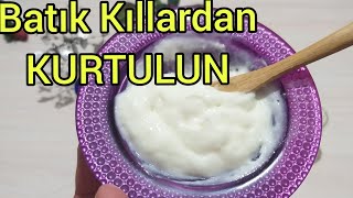 BÃœTÃ‡E DOSTU TARÄ°F Ä°LE KIL BATIKLARI Ã‡Ã–ZÃœM EVDE EN UCUZA ve PRATÄ°K OLARAK BATIK KILLARDAN KURTULMA [upl. by Anrol]