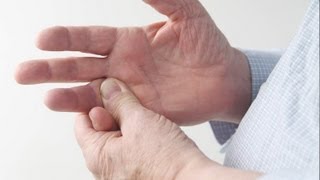 Psoriatic Arthritis  Treatment Options [upl. by Navannod]