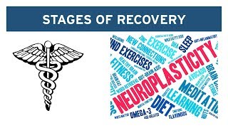 The 2Stage Recovery Process for Vestibular Disorders [upl. by Stein]