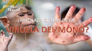 ¿AMENAZA GLOBAL DE LA VIRUELA DEL MONO [upl. by Bast]