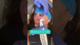 Undereye Bag Tightening Experience the Rockstar Treatment skintightening skincare clearskin [upl. by Hsaka]