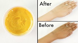 How To Remove Tan From FaceNeckHandsKnees Overnight Simple home remedie [upl. by Maurreen500]