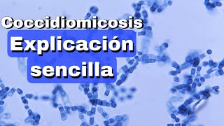 Coccidiomicosis fácil explicación [upl. by Eelloh]