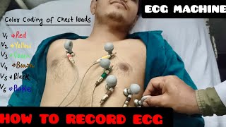 How To Record ECG  ECG leads Color Coding And Placement Location  ECG Machine [upl. by Eitteb985]