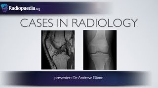 Cases in Radiology Episode 4 musculoskeletal MRI xray [upl. by Neesay]