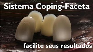 Cerâmicas com diferentes opacidades para dentes escuros sistema coping faceta [upl. by Editha]