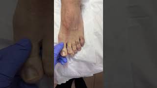 Professional Toe Waxing using hard wax Emerald green from Starpil waxing [upl. by Joselyn125]