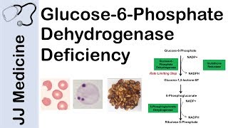 Glucose6Phosphate Dehydrogenase Deficiency  Symptoms Pathophysiology Diagnosis and Treatment [upl. by Atiuqer]