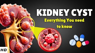 Kidney Cyst Renal Cyst – Causes Signs and Symptoms Diagnosis amp Treatment [upl. by Nohtahoj]