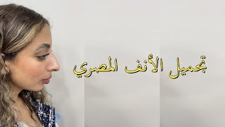 نتيجة رائعة تجميل الانف بالليزر مع دحسام ممدوح [upl. by Li898]