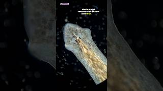 Freshwater Flatworm Under Microscope Planarian [upl. by Eirrol]