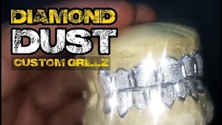 Real Custom Grillz 925 Sterling Silver Teeth Diamond Dust Grillz Set [upl. by Ilana]