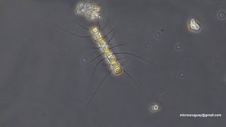 Chaetoceros diatomeas  diatoms [upl. by Sedaiuqlem]