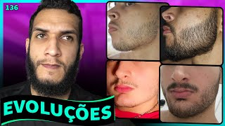 EVOLUÇÕES COM MINOXIDIL  BARBA ANTES E DEPOIS 136 [upl. by Roscoe243]