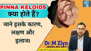 Ear piercing keloid Ear pinna keloid Treatment Ear piercing growth कान के छेद पर गांठ। [upl. by Olympe914]