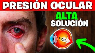 PRESIÓN OCULAR ALTA SOLUCIÓN SECRETA  Glaucoma  Salud Natural [upl. by Aidne]