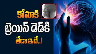 కోమాకి బ్రెయిన్ డెడ్కి తేడా ఇదే  Dr Sumanth Kumar Neurosurgeon about Coma and Brain Dead  Manamtv [upl. by Nothgierc189]