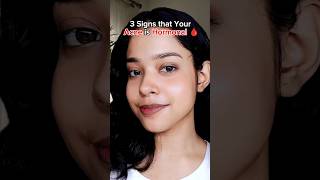 check Description 💓🎀 Hormonal Acne Solution Skincare Tips acne skincareroutine shortvideo [upl. by Maddi]