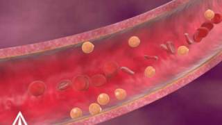 Cholesterol  3D Medical Animation [upl. by Talia]