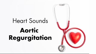 Aortic Regurgitation  Heart Sounds  MEDZCOOL [upl. by Ttenna]