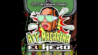 Tyga  Ayy Macarena Basshouse Remix  VIP DJ EL HERO [upl. by Doris47]