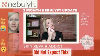 Nebulyft RF 2 Month Update  Before and After Photos [upl. by Tiena]