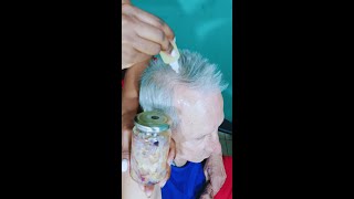 Tratamiento Casero para la Caída del Cabello  Como Hacer Crecer El Cabello Rápido [upl. by Arley]