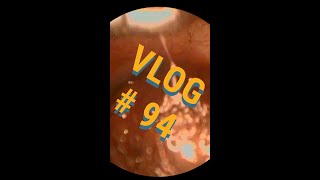 VLOG 94  What a mess GOOEY ear wax strikes again [upl. by Marabelle]