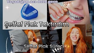 Şeffaf Plak Taktırdım  invisalign Tedavisi  Şeffaf Plak Sürecinde Yaşadıklarım [upl. by Jestude639]