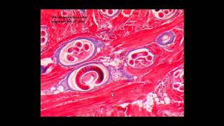 ORGANISM SLIDE Trichinella spiralis Microscope Slide [upl. by Boiney]