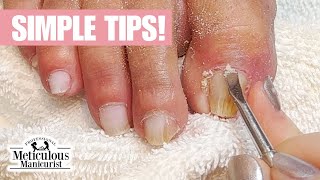 Toenail Cleaning at Home Tutorial [upl. by Elinad]