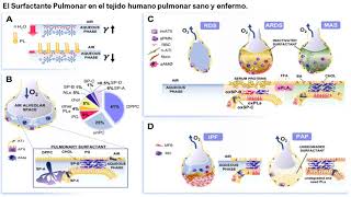 Neo Actual  Conceptos Biofísicos del Surfactante Pulmonar [upl. by Kurys529]