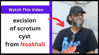 Excision of scrotum cyst from Noakhali manikganj [upl. by Sima]