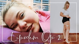 MEINE 2 LIPÖDEM OP 🙊  Meine Klinik Liposuktion amp die Heilung Vlog [upl. by Adikram]