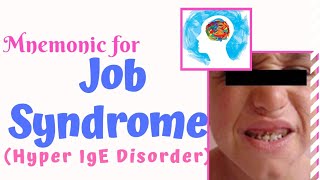 Job Syndrome Hyper IgE Syndrome Mnemonic [upl. by Rai]