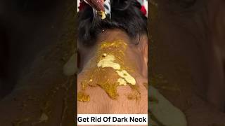 Dark Neck Removal Dark Neck Home Remedy darkneck necktanning shorts neckcleaning skincare [upl. by Pedaiah578]