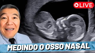 AO VIVO MEDINDO O OSSO NASAL [upl. by Cavil465]