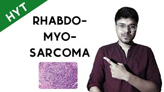 Rhabdomyosarcoma  HYT  NEETPG  INICET  FMGE pathology [upl. by Atiek917]