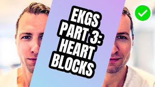 How to Read EKGs Like A Boss Part 3 Heart Blocks [upl. by Nylitsirk201]